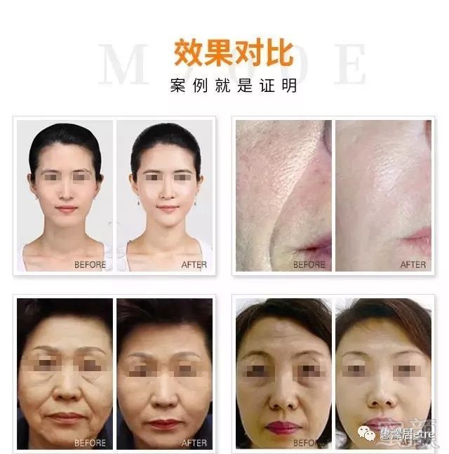 https://img.miyanlife.com/mnt/timg/181001/11442W5D-6.jpg