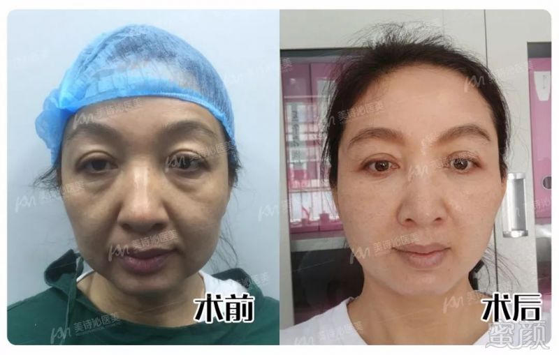 https://img.miyanlife.com/mnt/timg/181001/11544A1S-10.jpg