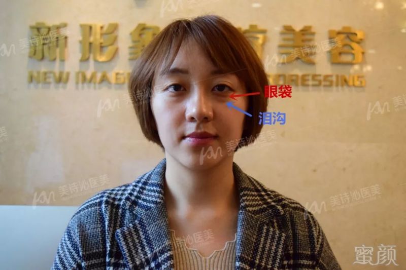 https://img.miyanlife.com/mnt/timg/181001/11544I060-11.jpg