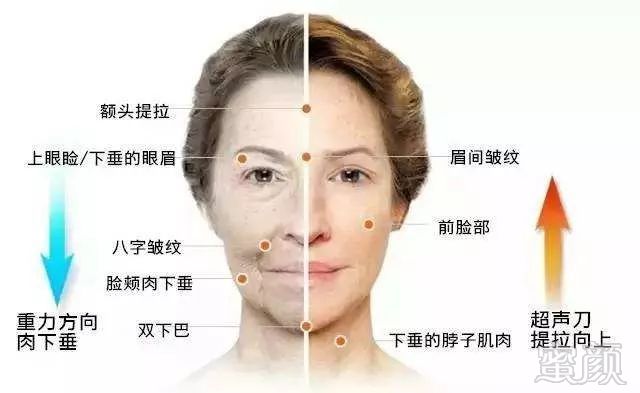 https://img.miyanlife.com/mnt/timg/181001/115KM018-7.jpg