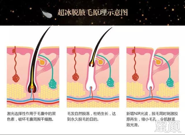 https://img.miyanlife.com/mnt/timg/181001/115U13345-4.jpg