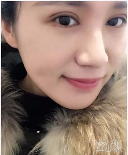 https://img.miyanlife.com/mnt/timg/181001/1201044454-2.jpg