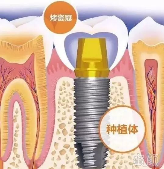 https://img.miyanlife.com/mnt/timg/181001/1224164094-1.jpg
