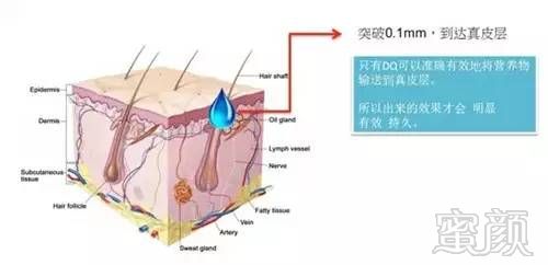 案例图片