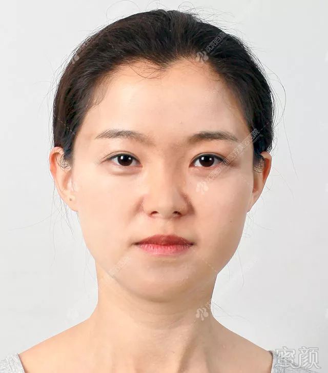 https://img.miyanlife.com/mnt/timg/181002/1119352B3-0.jpg