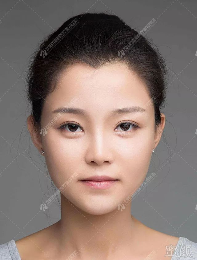 https://img.miyanlife.com/mnt/timg/181002/1119362262-6.jpg