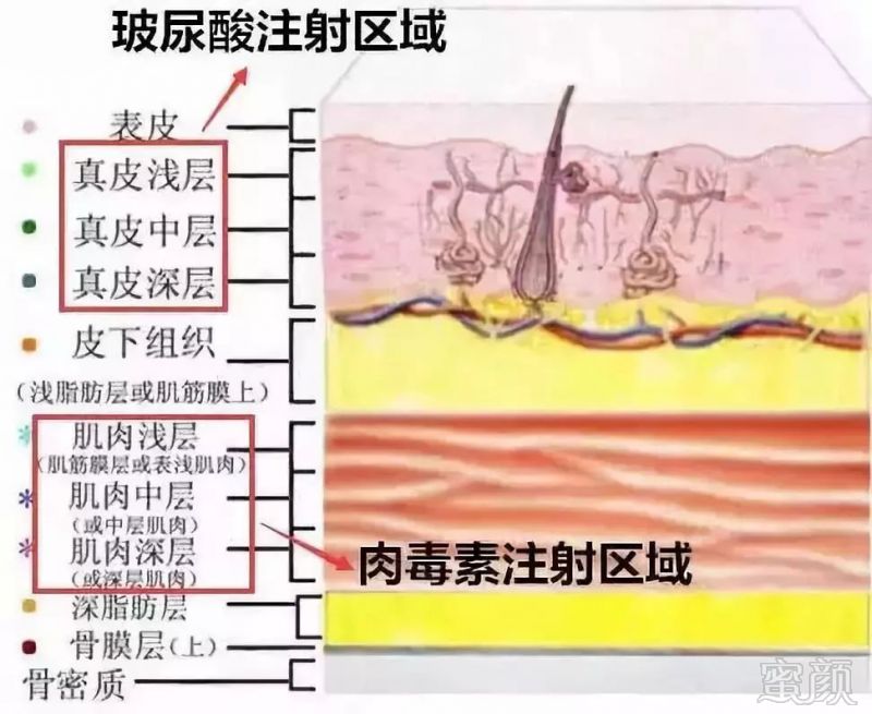 https://img.miyanlife.com/mnt/timg/181002/1124192033-4.jpg