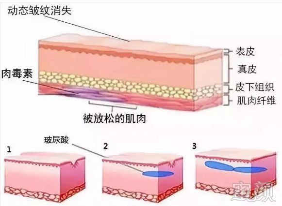 https://img.miyanlife.com/mnt/timg/181002/11241S305-3.jpg