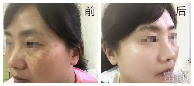 https://img.miyanlife.com/mnt/timg/181002/1131201541-5.jpg