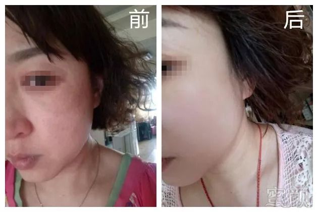 https://img.miyanlife.com/mnt/timg/181002/1131204319-6.jpg