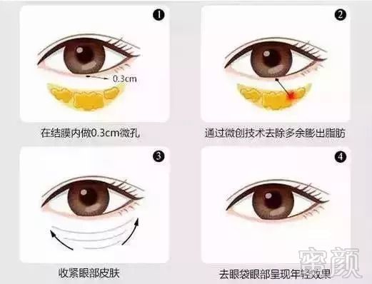 https://img.miyanlife.com/mnt/timg/181002/1134211163-2.jpg