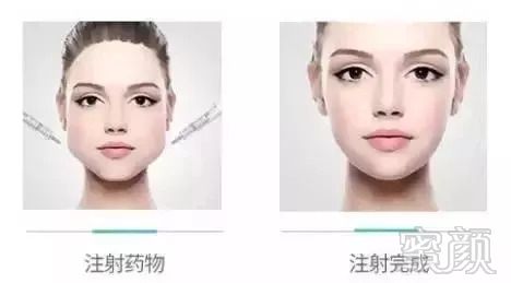 https://img.miyanlife.com/mnt/timg/181002/1139523b9-6.jpg