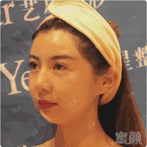 https://img.miyanlife.com/mnt/timg/181002/1144211237-3.jpg