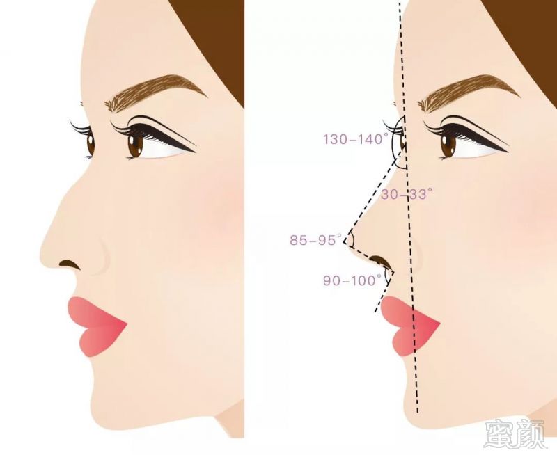 https://img.miyanlife.com/mnt/timg/181002/1144214D1-5.jpg