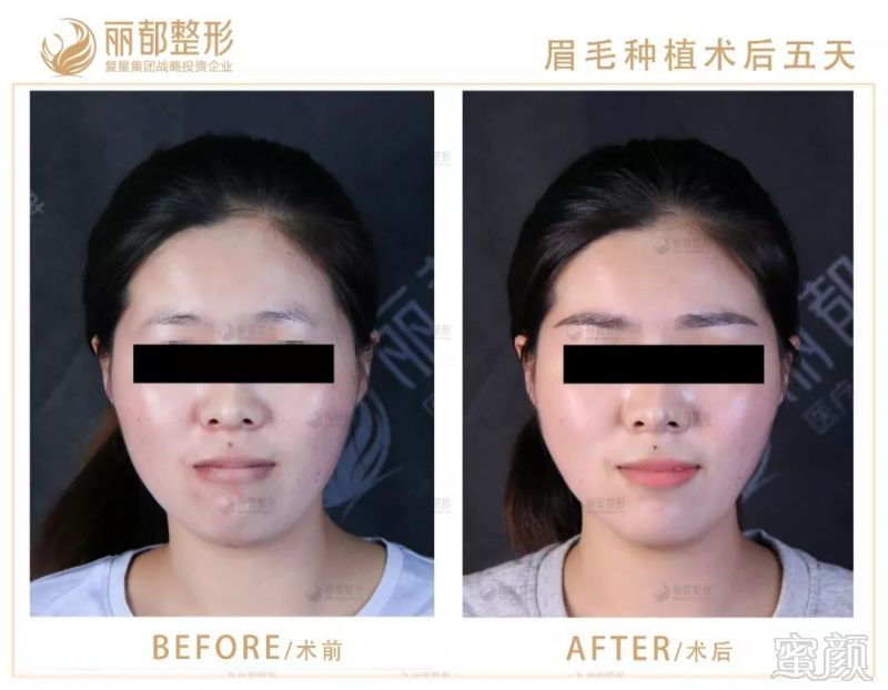 https://img.miyanlife.com/mnt/timg/181002/114K4FE-8.jpg