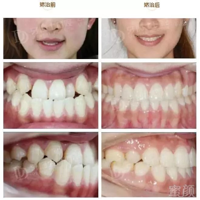 https://img.miyanlife.com/mnt/timg/181002/115A31X6-7.jpg