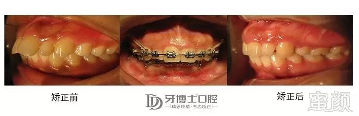 https://img.miyanlife.com/mnt/timg/181002/115A33331-9.jpg