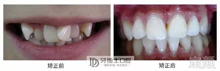 https://img.miyanlife.com/mnt/timg/181002/115A35351-8.jpg