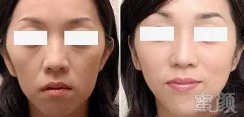 https://img.miyanlife.com/mnt/timg/181003/1036325E6-3.jpg