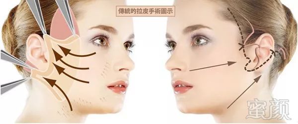 https://img.miyanlife.com/mnt/timg/181003/103U22051-3.jpg