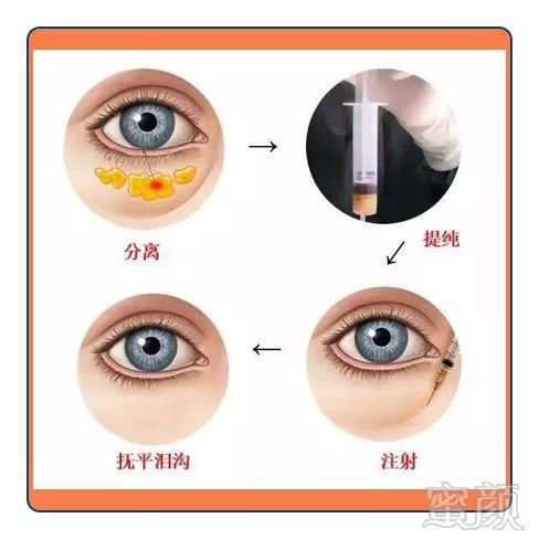 https://img.miyanlife.com/mnt/timg/181003/10433B3J-4.jpg