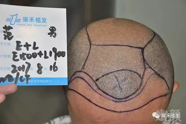 https://img.miyanlife.com/mnt/timg/181003/1046063154-6.jpg