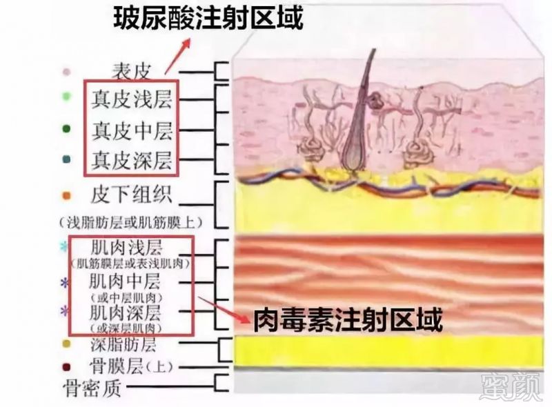 https://img.miyanlife.com/mnt/timg/181003/105S21260-8.jpg