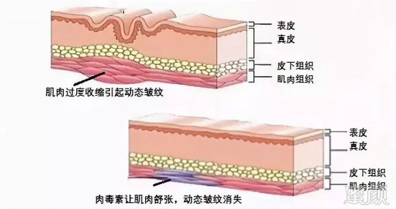 https://img.miyanlife.com/mnt/timg/181003/105S22226-6.jpg