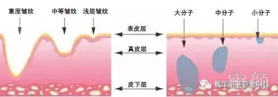 https://img.miyanlife.com/mnt/timg/181003/11062TD6-2.jpg
