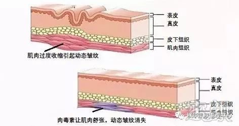 https://img.miyanlife.com/mnt/timg/181003/11062TF0-3.jpg