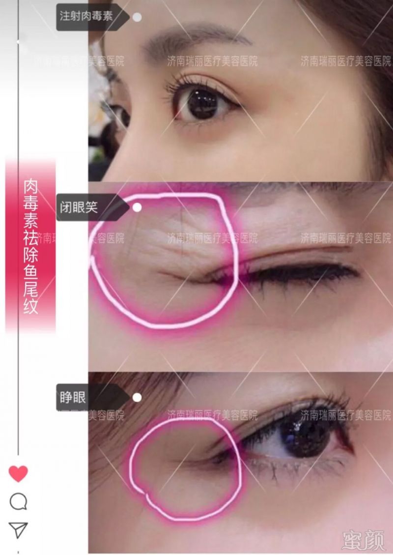 https://img.miyanlife.com/mnt/timg/181003/110G64L0-5.jpg