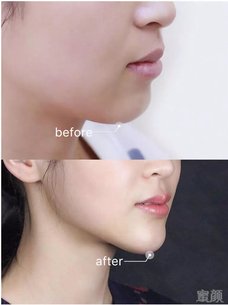 https://img.miyanlife.com/mnt/timg/181003/11253U1N-2.jpg