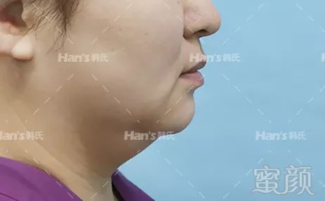 https://img.miyanlife.com/mnt/timg/181003/112R2N01-7.jpg