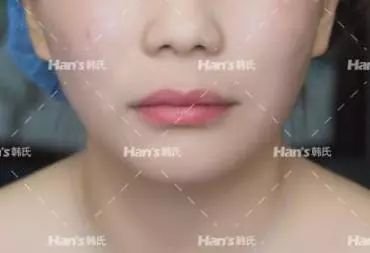 https://img.miyanlife.com/mnt/timg/181003/112R33525-11.jpg