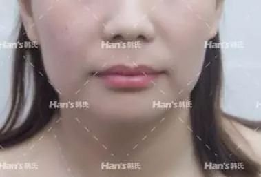 https://img.miyanlife.com/mnt/timg/181003/112R3G46-10.jpg