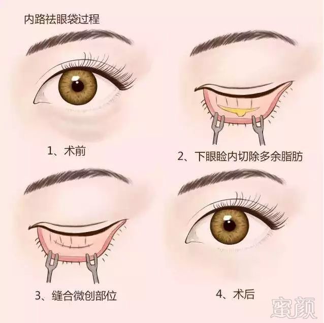 https://img.miyanlife.com/mnt/timg/181003/120623GO-6.jpg