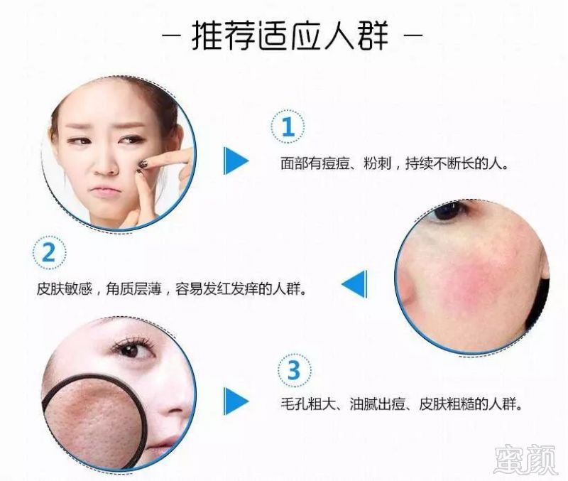 https://img.miyanlife.com/mnt/timg/181003/121I44611-8.jpg