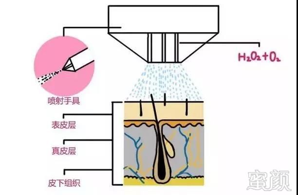 案例图片