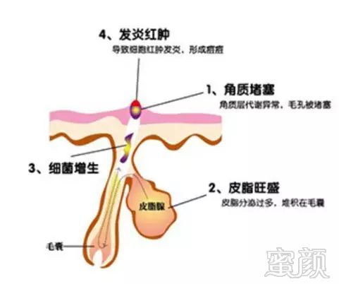https://img.miyanlife.com/mnt/timg/181004/0Z6121063-11.jpg