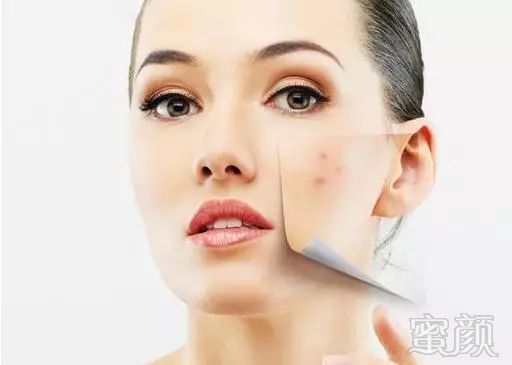 https://img.miyanlife.com/mnt/timg/181004/0Z6121414-12.jpg