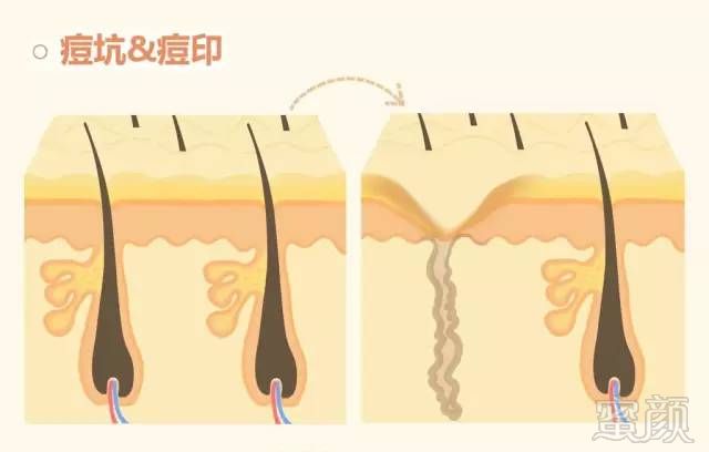 https://img.miyanlife.com/mnt/timg/181004/0Z6124559-5.jpg