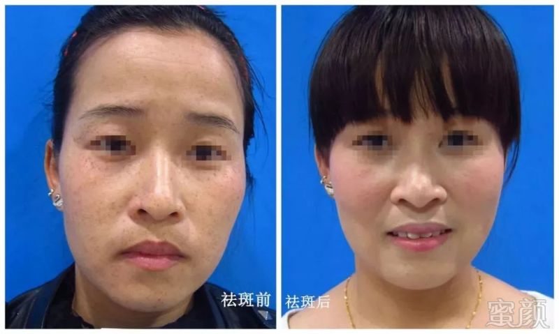 https://img.miyanlife.com/mnt/timg/181004/10091913Q-4.jpg