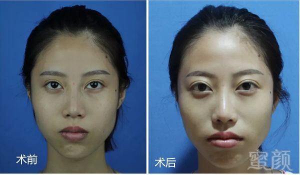 https://img.miyanlife.com/mnt/timg/181004/1009191T4-5.jpg