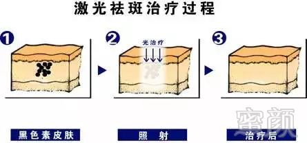 https://img.miyanlife.com/mnt/timg/181004/1059233496-1.jpg