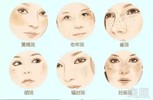 https://img.miyanlife.com/mnt/timg/181004/10592342H-0.jpg