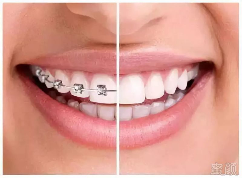 https://img.miyanlife.com/mnt/timg/181004/1102422V0-5.jpg