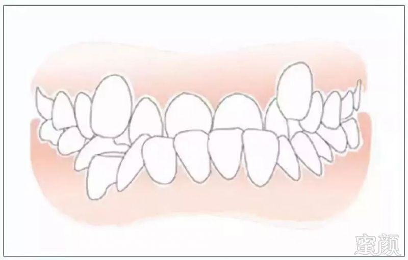 https://img.miyanlife.com/mnt/timg/181004/11024252H-4.jpg
