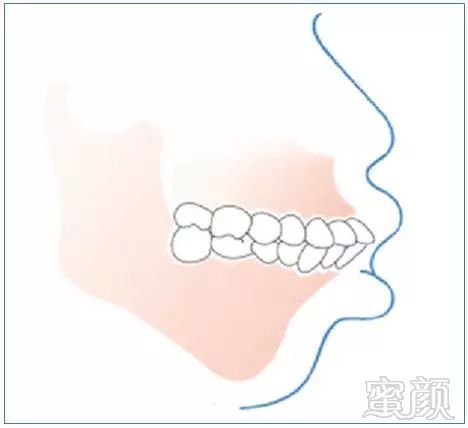 https://img.miyanlife.com/mnt/timg/181004/1102426218-3.jpg