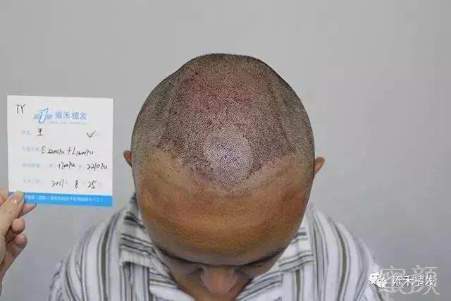 https://img.miyanlife.com/mnt/timg/181004/1103515S1-5.jpg