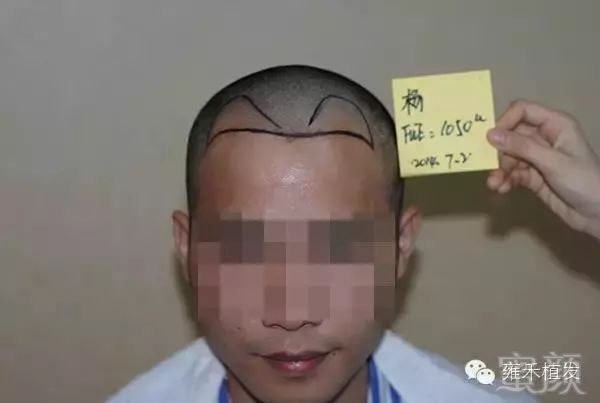 https://img.miyanlife.com/mnt/timg/181004/1105513G5-2.jpg